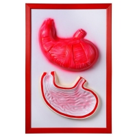 Барельефная модель "Желудок" - «globural.ru» - Архангельск