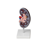 Модель почки в разрезе - «globural.ru» - Архангельск