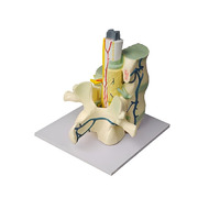 Модель части позвоночника человека - «globural.ru» - Архангельск