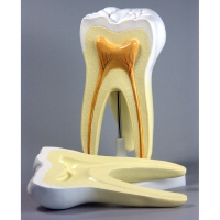 Модель "Строение зуба" - «globural.ru» - Архангельск