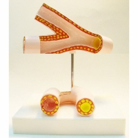 Модель "Здоровые и поврежденные сосуды"	 - «globural.ru» - Архангельск