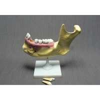 Модель "Челюсть разборная" - «globural.ru» - Архангельск