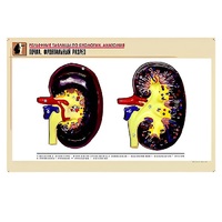 Рельефная таблица "Почка. Фронтальный разрез" (формат А1, матовое ламинир.) - «globural.ru» - Архангельск